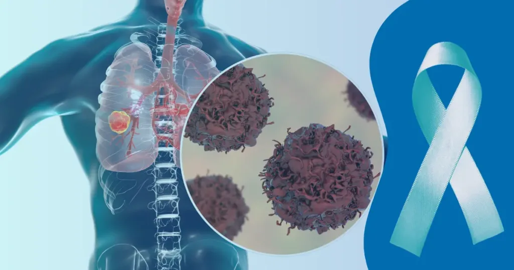 An awareness symbol and cancer-affected lungs promoting the need to prevent lung cancer. 