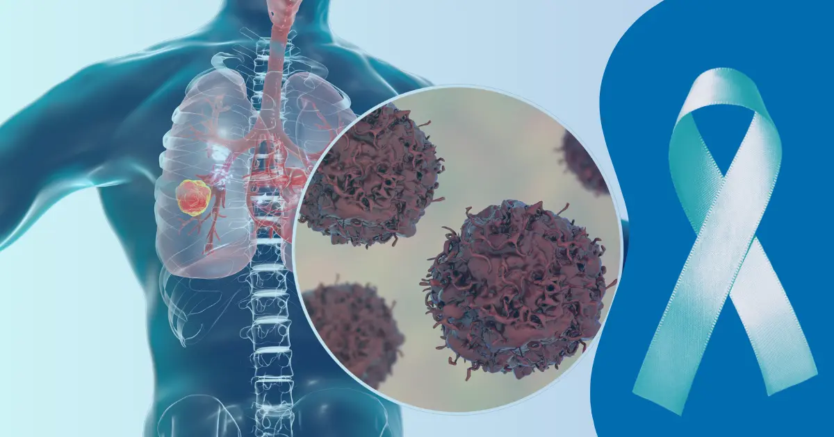 An awareness symbol and cancer-affected lungs promoting the need to prevent lung cancer.